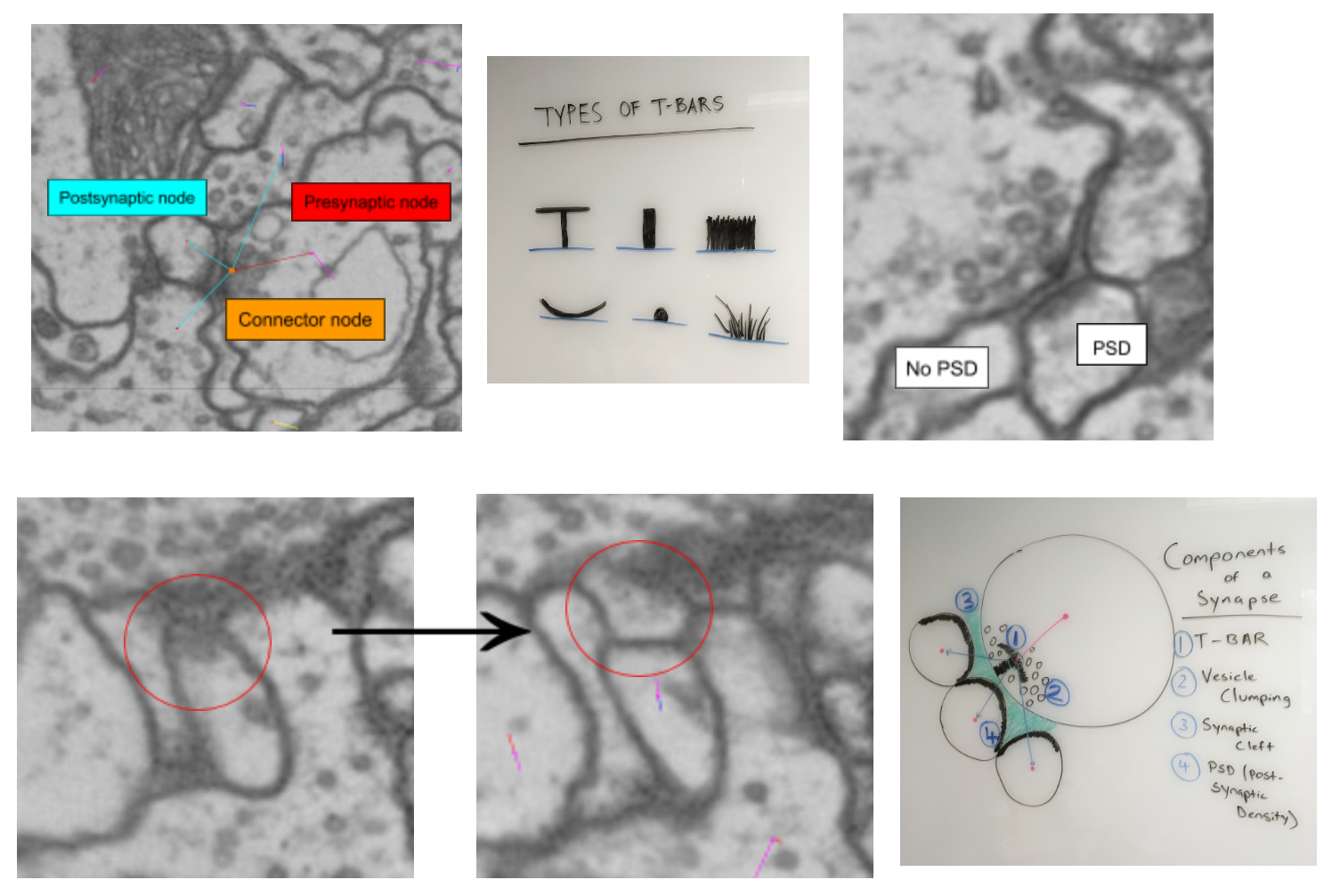 Synapses
